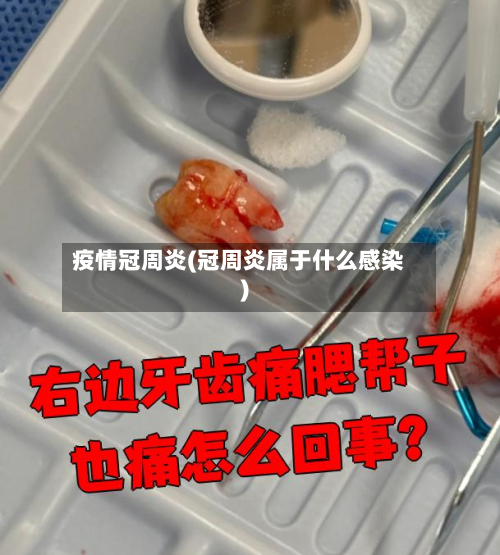 疫情冠周炎(冠周炎属于什么感染)-第1张图片